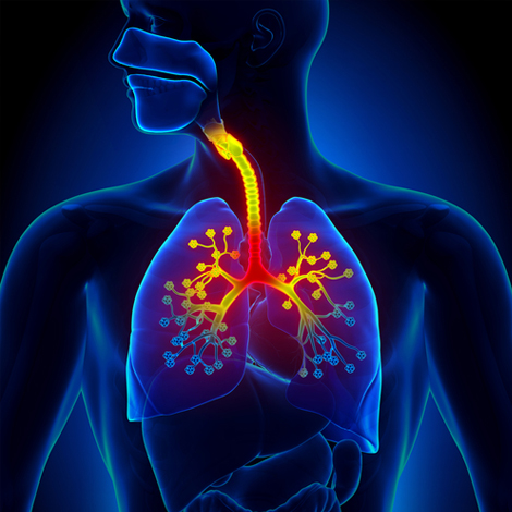Asthma
