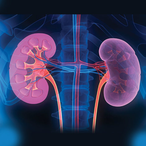Kidney/Gallstone