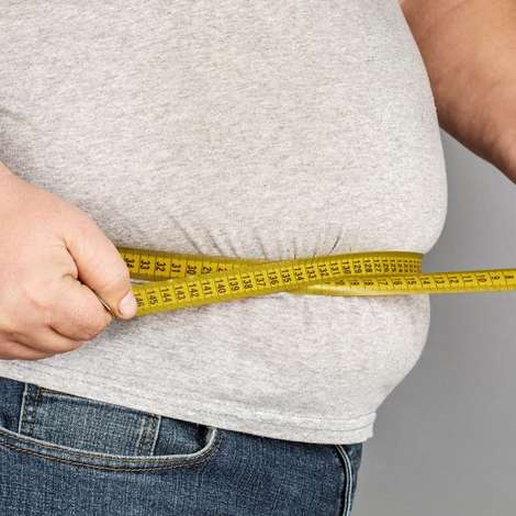 Obesity