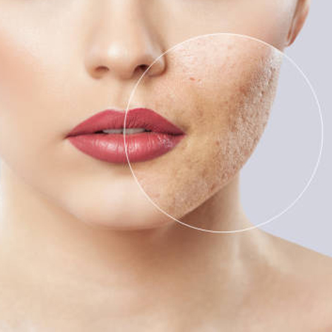 Skin Problem