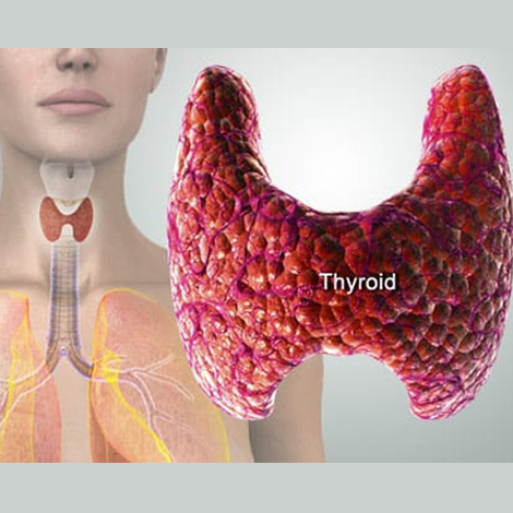 Thyroid Problem